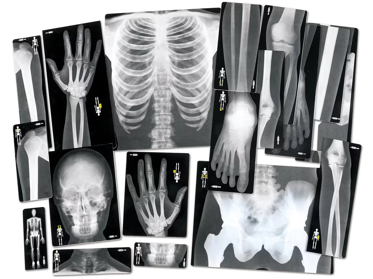 Human X-Rays - Set of 18 - US 2659