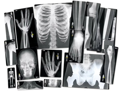 Human X-Rays - Set of 18 - US 2659