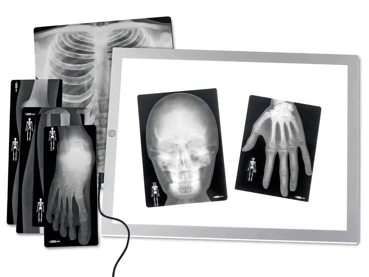 Human X-Rays - Set of 18 - US 2659
