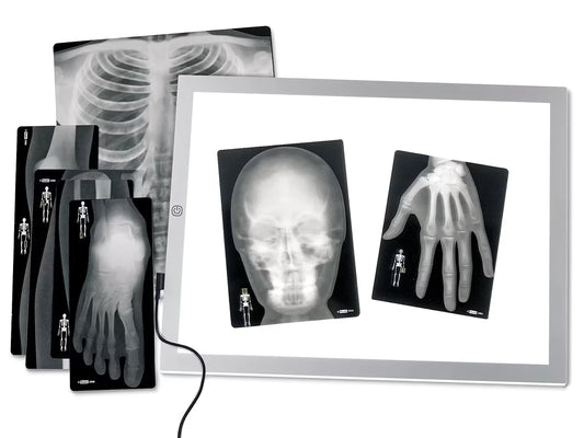Human X-Rays - Set of 18 - US 2659